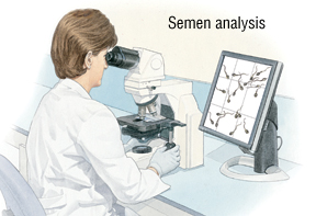 SEMEN-ANALYSIS-Sperm-count-2