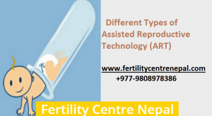 assisted reproductive technology (ART)