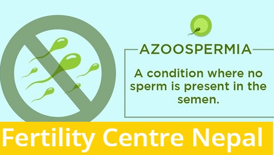 Azoospermia cost in Nepal