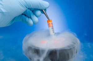 Embryo Freezing Nepal